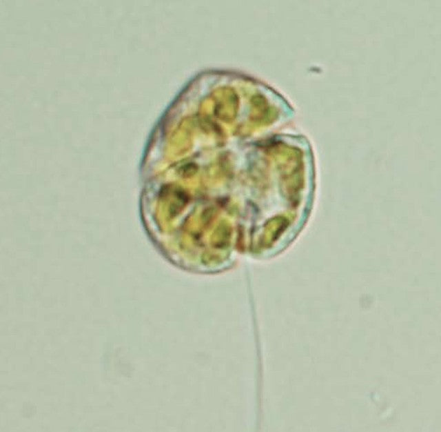 Algae Bloom 1/3 the size of Florida Found in Australia