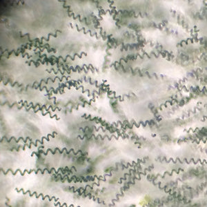 Spirulina culture, helical tricomes from Algae Research Supply.